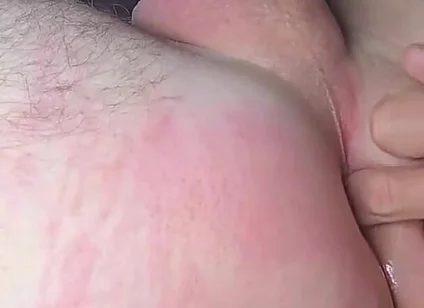 Amateur Anal Stretch
